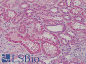 Anti-GSTM1 / MU Antibody IHC-plus LS-B4796