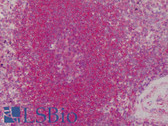 Anti-TPM1 / Tropomyosin Antibody IHC-plus LS-B4800