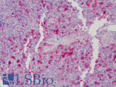Anti-GSN / Gelsolin Antibody IHC-plus LS-B4801
