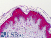 Anti-ACVR2 / ACVR2A Antibody (N-Terminus) IHC-plus LS-B4803