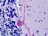 Anti-OSBPL1A / ORP1 Antibody (C-Terminus) IHC-plus LS-B4811