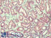 Anti-ARF1 Antibody IHC-plus LS-B4817