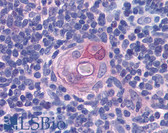 Anti-PYCARD / ASC Antibody (aa31-46) IHC-plus LS-B4826