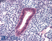 Anti-FOXN1 Antibody IHC-plus LS-B4832