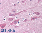 Anti-GABRB1 Antibody IHC-plus LS-B4834