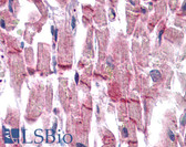 Anti-VCL / Vinculin Antibody IHC-plus LS-B4848