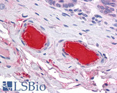Anti-Complement C9 Antibody IHC-plus LS-B4849