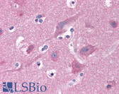 Anti-PAK1 Antibody IHC-plus LS-B4853