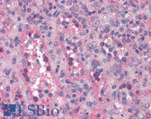 Anti-BUB1B / BubR1 Antibody IHC-plus LS-B4854