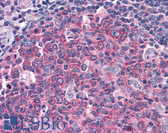 Anti-IDE Antibody IHC-plus LS-B4856