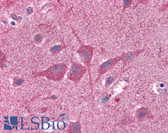 Anti-NUMB Antibody IHC-plus LS-B4857