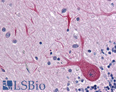 Anti-BUB3 Antibody IHC-plus LS-B4858