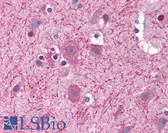 Anti-CCT2 / CCT Beta Antibody IHC-plus LS-B4861