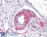 Anti-ERG Antibody IHC-plus LS-B4864