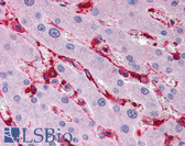 Anti-FLNA / Filamin A Antibody IHC-plus LS-B4865