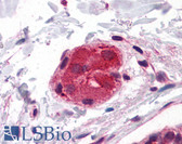 Anti-LRRK2 Antibody IHC-plus LS-B4868