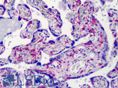 Anti-IKBKG / NEMO / IKK Gamma Antibody (clone 46B844) IHC-plus LS-B4878