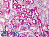 Anti-COMT Antibody (N-Terminus) IHC-plus LS-B4880
