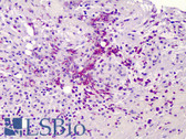 Anti-FAP Alpha Antibody (Internal) IHC-plus LS-B4903