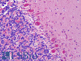 Anti-EPHA6 / EPH Receptor A6 Antibody (aa891-940) IHC-plus LS-B4905