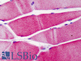 Anti-ACTN3 Antibody (aa1-50) IHC-plus LS-B4907