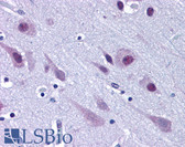 Anti-TDP-43 / TARDBP Antibody (C-Terminus) IHC-plus LS-B4917