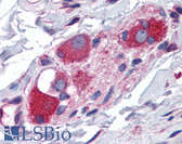 Anti-ARL6IP5 Antibody (C-Terminus) IHC-plus LS-B4924