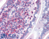 Anti-FNBP1 / FBP17 Antibody (Internal) IHC-plus LS-B4929