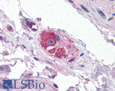 Anti-CYP26B1 Antibody (Internal) IHC-plus LS-B4934