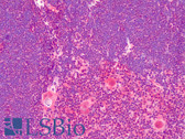 Anti-PRKD2 / PKD2 Antibody (aa850-865) IHC-plus LS-B4944