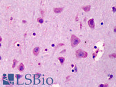 Anti-MCL1 / MCL 1 Antibody IHC-plus LS-B4956