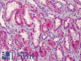 Anti-HGF Antibody (C-Terminus) IHC-plus LS-B4957