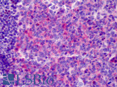 Anti-NRG1 / Heregulin / Neuregulin Antibody (aa1-50) IHC-plus LS-B4958