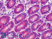 Anti-GPR52 Antibody (aa311-360) IHC-plus LS-B4959