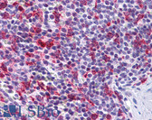 Anti-PCDH12 / VE-Cadherin-2 Antibody (N-Terminus) IHC-plus LS-B4995