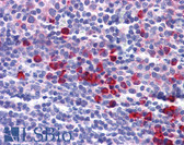 Anti-KITLG / SCF Antibody (Internal) IHC-plus LS-B5002