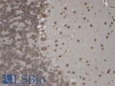 Anti-TRPM7 Antibody (aa1817-1863, clone S74-25) IHC-plus LS-B5030