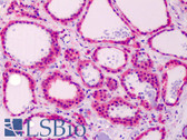 Anti-Calmodulin Antibody (C-Terminus) IHC-plus LS-B5031