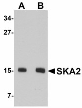 Anti-SKA2 Antibody (N-Terminus) IHC-plus LS-B5038