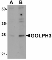 Anti-GOLPH3 Antibody (N-Terminus) IHC-plus LS-B5044