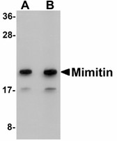 Anti-NDUFAF2 / NDUFA12L Antibody (C-Terminus) IHC-plus LS-B5045