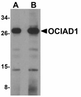 Anti-OCIAD1 Antibody (C-Terminus) IHC-plus LS-B5046