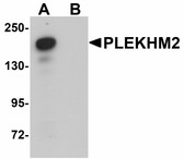 Anti-PLEKHM2 / SKIP Antibody (C-Terminus) IHC-plus LS-B5051