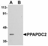 Anti-PPAPDC2 Antibody (C-Terminus) IHC-plus LS-B5057