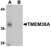 Anti-TMEM38A Antibody (C-Terminus) IHC-plus LS-B5059