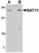 Anti-NAA40 Antibody (C-Terminus) IHC-plus LS-B5064