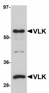 Anti-PKDCC / SGK493 Antibody (Internal) IHC-plus LS-B5068