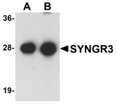 Anti-SYNGR3 / Synaptogyrin 3 Antibody (C-Terminus) IHC-plus LS-B5071