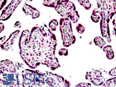 Anti-BRIP1 / BACH1 Antibody (aa1233-1249) IHC-plus LS-B5084