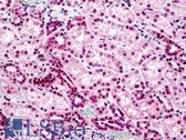 Anti-STEAP2 Antibody (aa455-467) IHC-plus LS-B5085